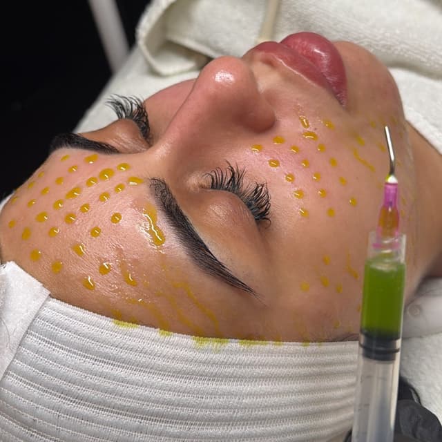 BioRePeel Package of 3 at Glow by Jess in Troy, MI